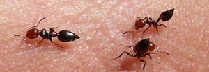 acido del piquete de la hormiga 1