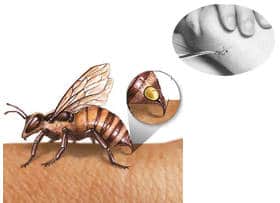 Las alergias a las picaduras de abejas; ¿Cómo ocurre?¿Qué hacer?