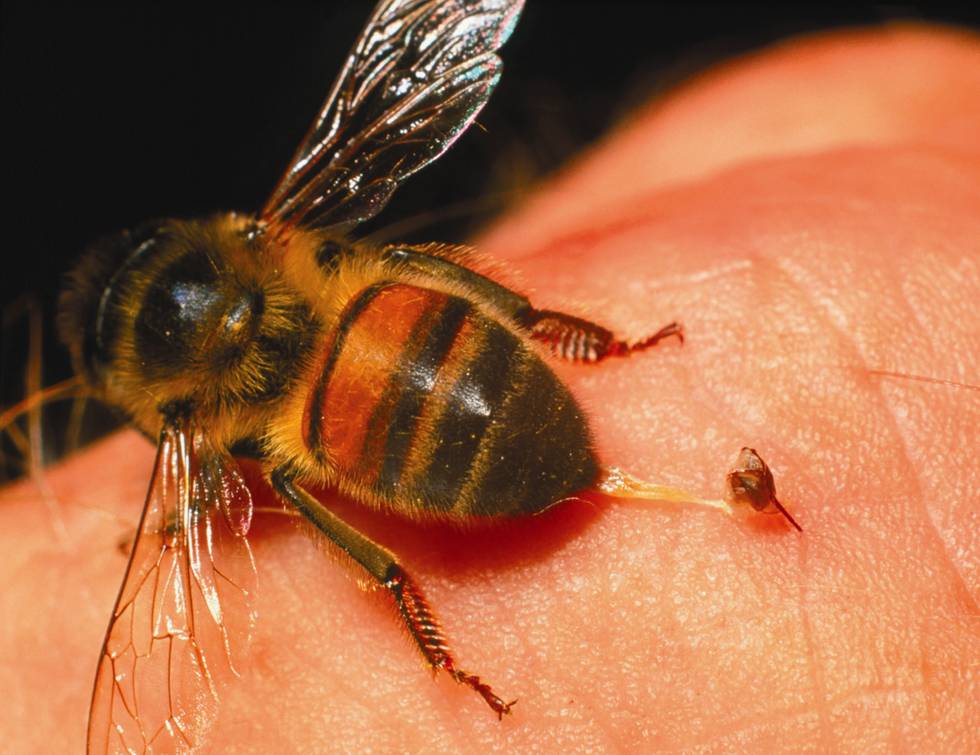 Alergia a piquetes de insectos causas y consecuencias