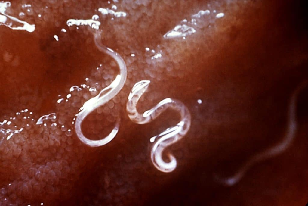 lombrices intestinales Síntomas, tratamiento, remedios caseros y más lombrices intestinales Síntomas, tratamiento, remedios caseros y más