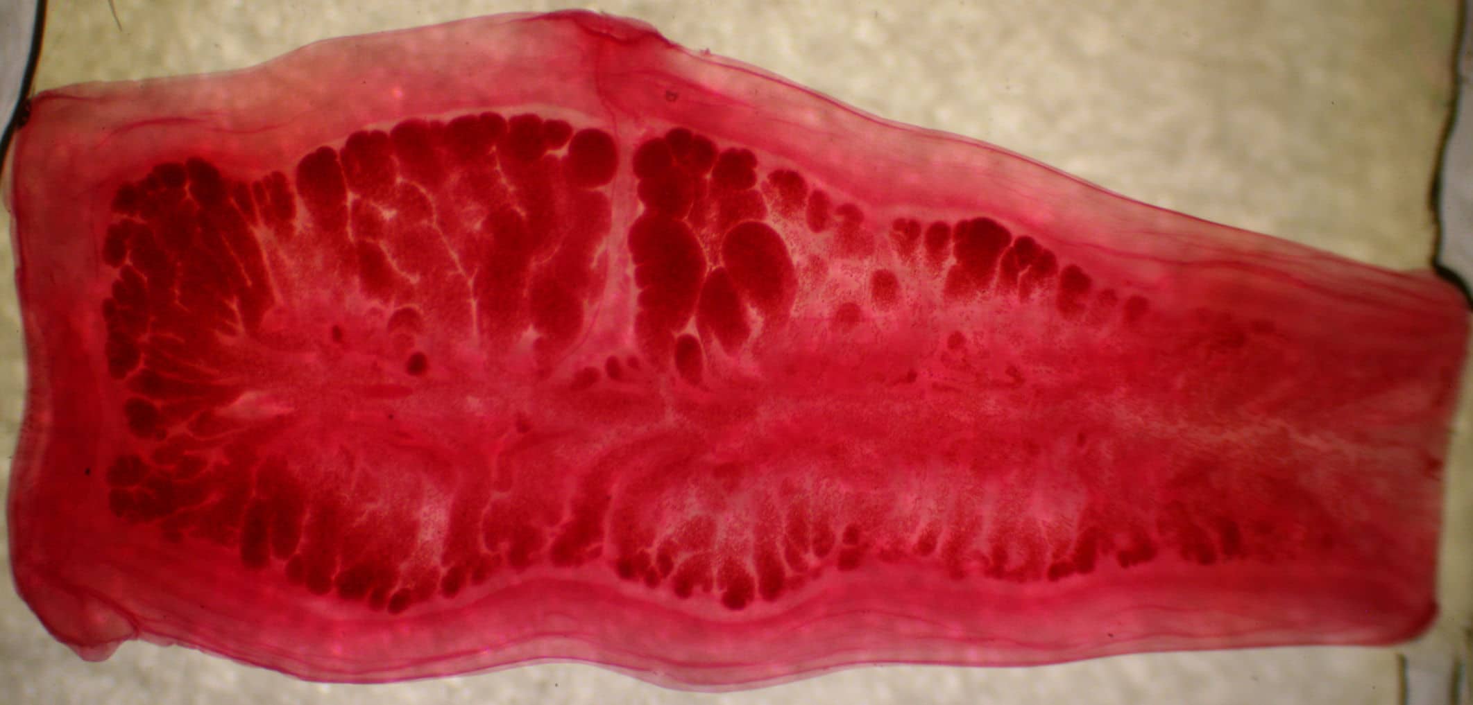 Lombriz solitaria o solitaria parásito