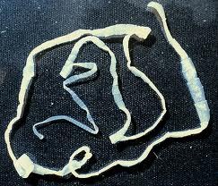 Lombríz-solitaria-o-solitaria-parasito13