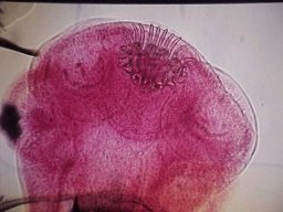 Lombríz-solitaria-o-solitaria-parasito5