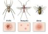 Picaduras de insectos: Enfermedades, síntomas, tratamiento y más.